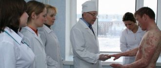 Атопический дерматит