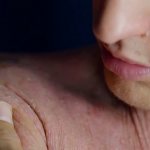 Псориаз цикличен – на первом этапе проявляются красные пятна